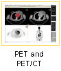 PET and PET/CT