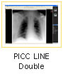 PICC line double diagnostic x-ray